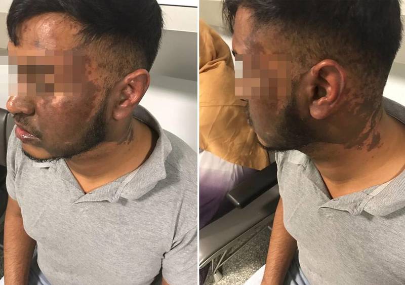 بحران اسیدپاشی و چاقوکشی در لندن/ زیر پوست پایتخت بریتانیا چه می‌گذرد؟ +عکس