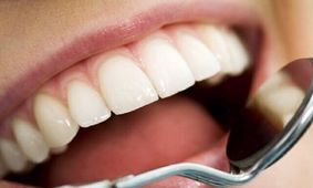 جرم گیری پایه ای ترین درمان دندانپزشکی و بی ضرر است