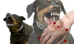چگونه از ابتلا به "هاری" پیش‌گیری کنیم؟