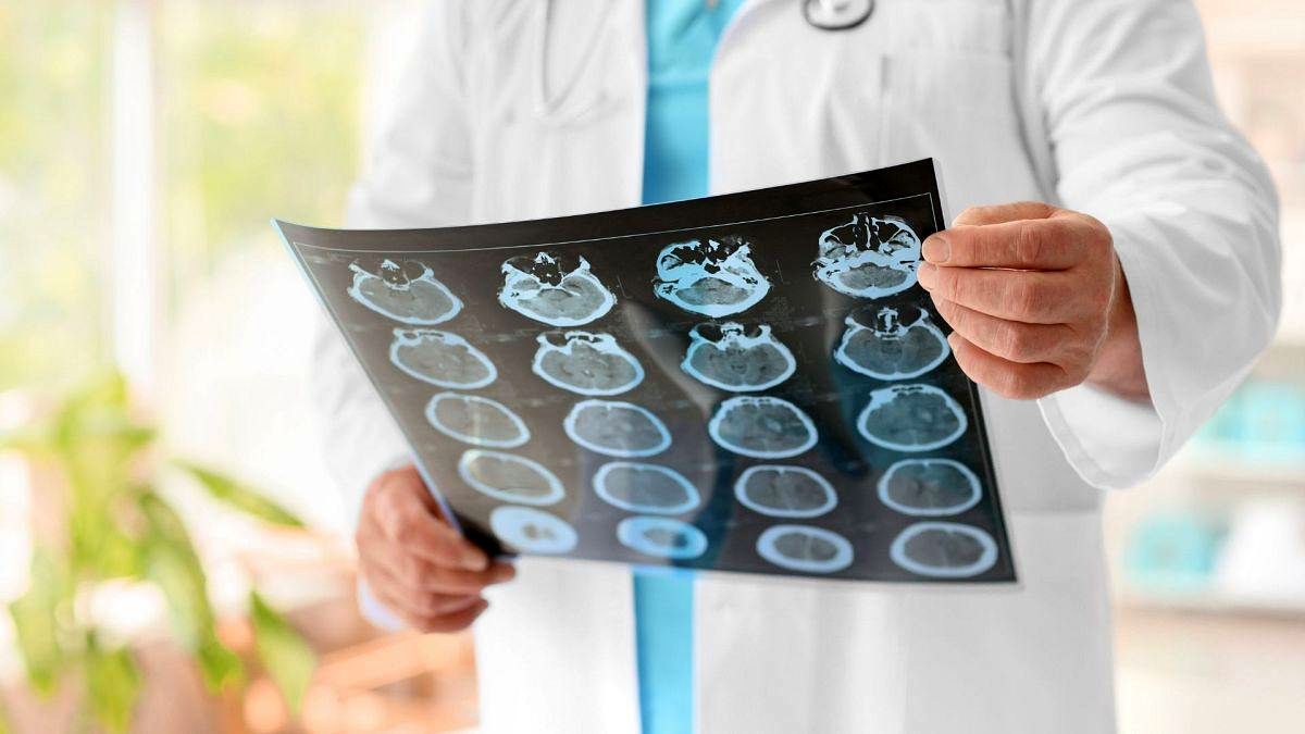 تشخیص آلزایمر از راه آزمایش خون با دقت ۹۱ درصدی ممکن می‌شود

