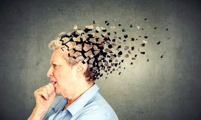 بررسی تاثیر هورمون درمانی روی زنان مستعد ابتلا به آلزایمر