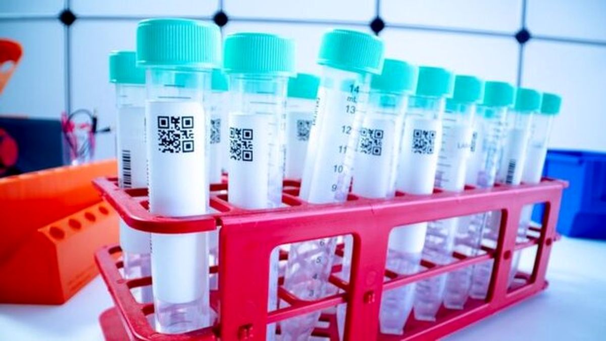 معیار اعلام آمار فوتی‌‌های کرونا تست مثبت PCR است
