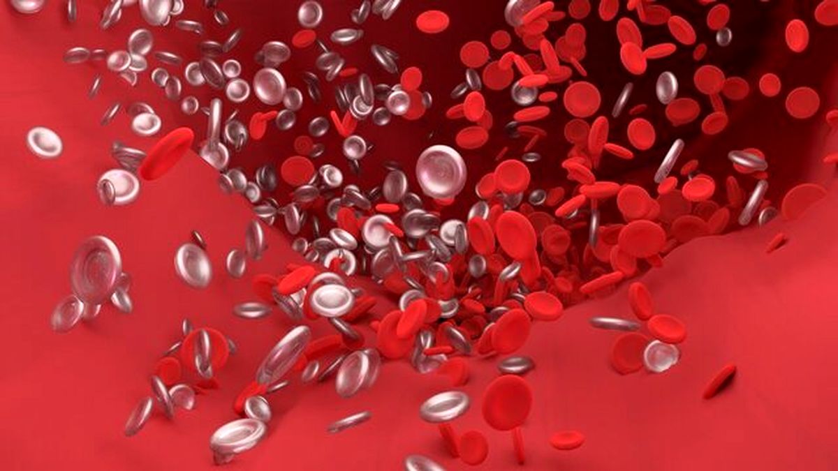 ابداع یک روش غیرتهاجمی برای شناسایی لخته خون در قلب