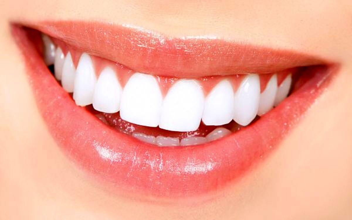 راهکار‌های خانگی برای سفید کردن دندان‌ها