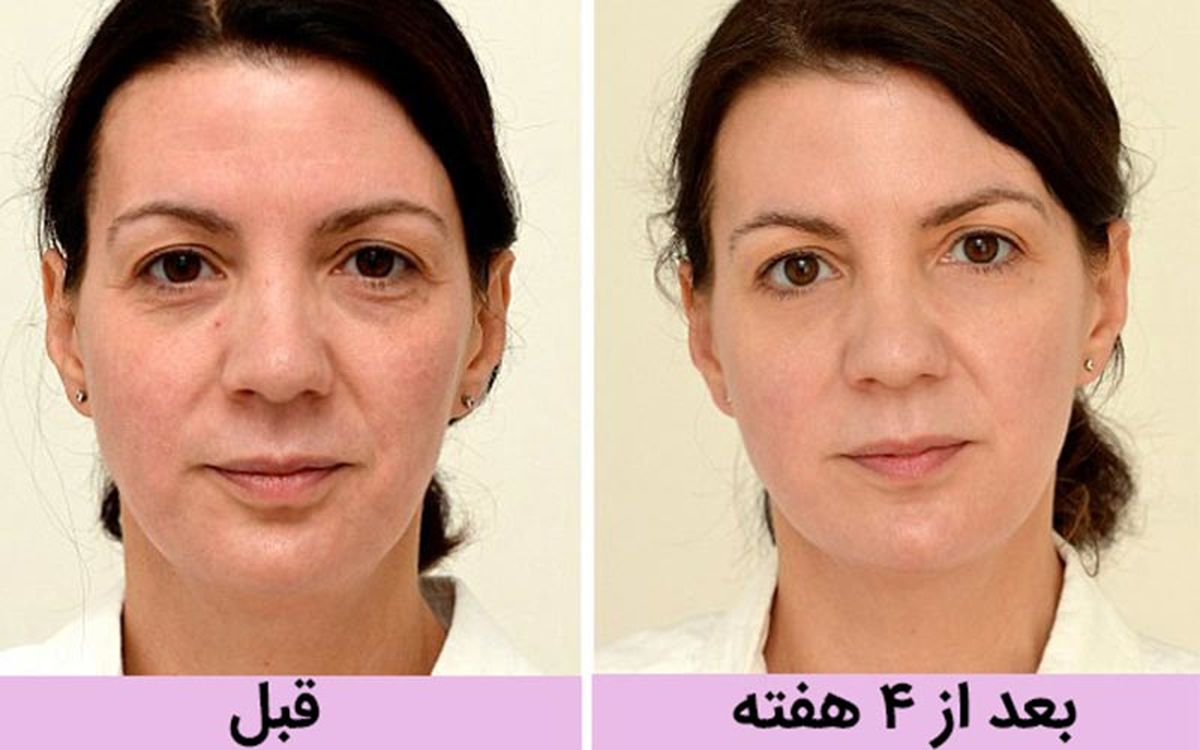 روایت زنی بریتانیای که با معجزه ی آب 10 سال جوانتر شد