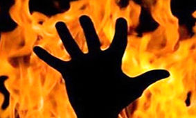 به آتش کشیدن همکار در دفتر کار