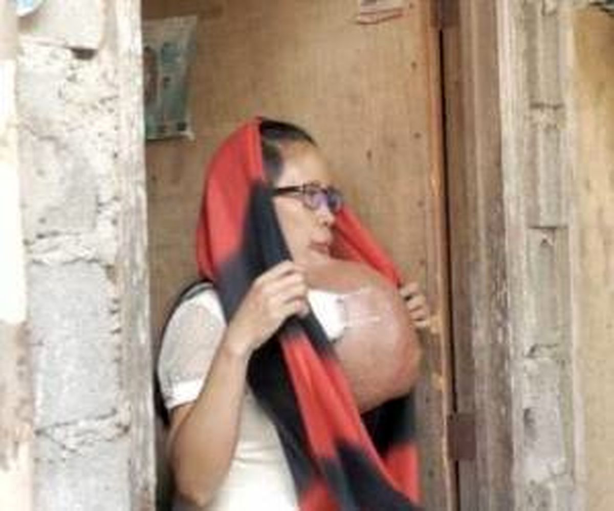 زندگی غم انگیز مادر جوان با تومور بزرگ زیر فکش + تصاویر