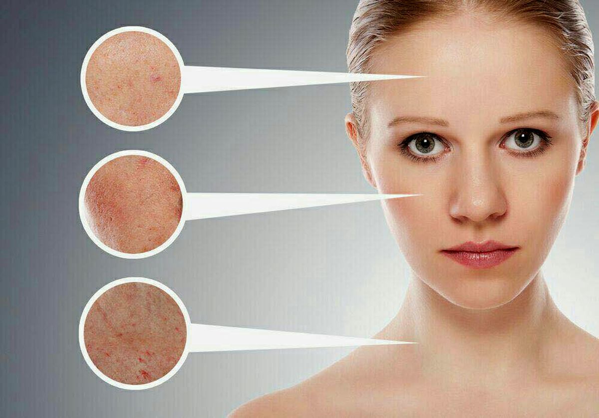 بیماری های پوستی ناشی از بدکاری کبد