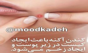 این نوع جوش ها را هرگز نترکانید!