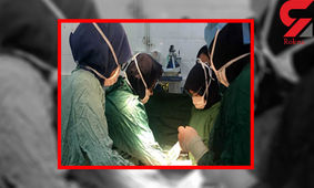 کیست 17 کیلوگرمی در شکم زن 72 ساله قزوینی جا خوش کرده بود+عکس