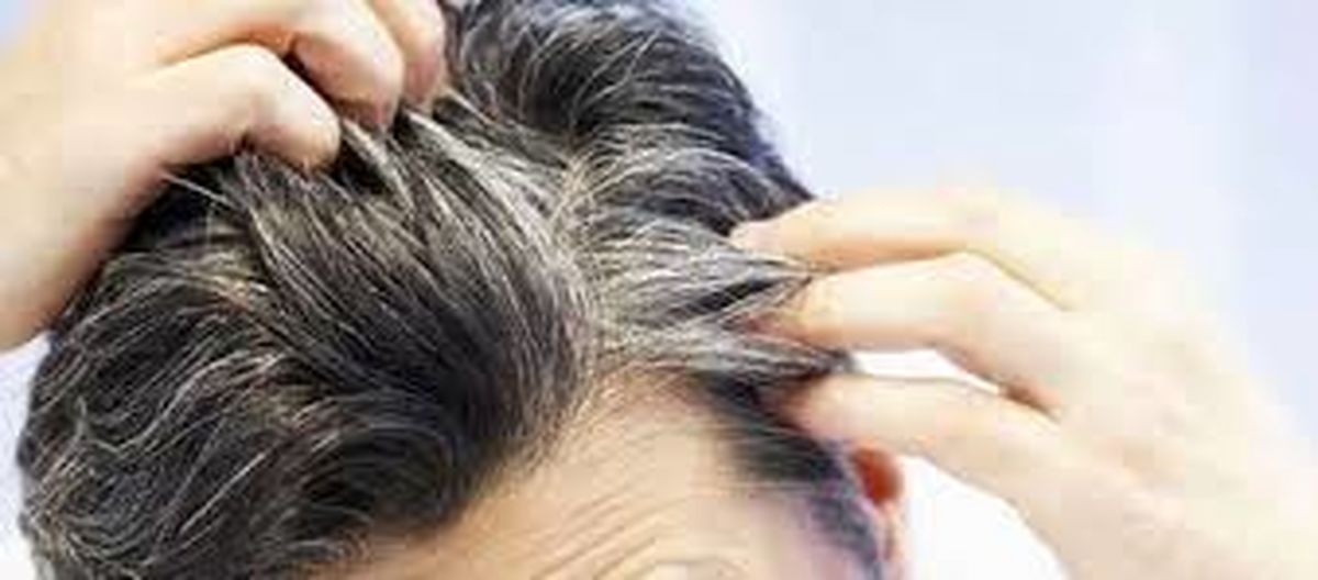 کدام مواد غذایی جلوی سفید شدن موی شما را می‌گیرد؟