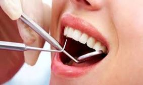 با جرم گیری دندان ها از شر میکروب ها خلاص شوید