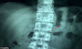ایرپادهای اپل از سفر کامل در بدن انسان جان سالم به در بردند