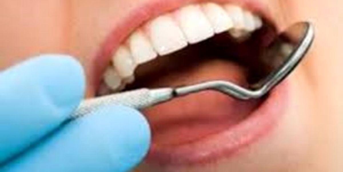 مکش‌های پزشکی با کمترین هزینه بومی‌سازی شد