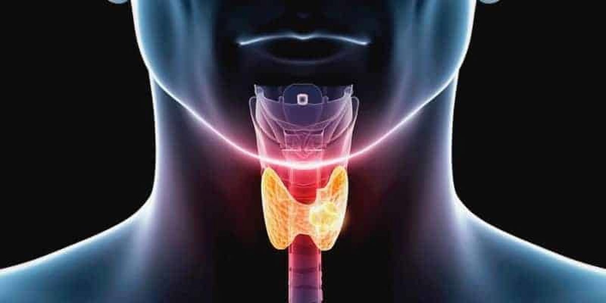 برخی خوراکی‌ ها صدای شما را زیبا می‌کند