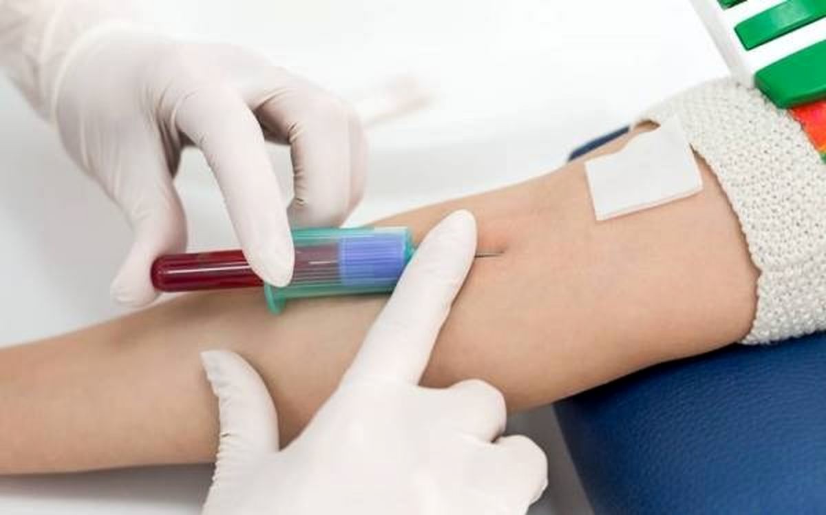 تشخیص سریع سرطان تخمدان تنها با یک آزمایش خون