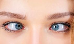 آیا لوچ کردن چشم‌ها از روی عمد واقعاً خطرناک است؟ 