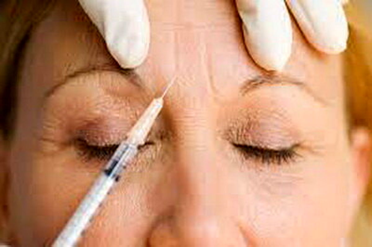 چند هشدار درباره تزریق ژل یا چربی به صورت